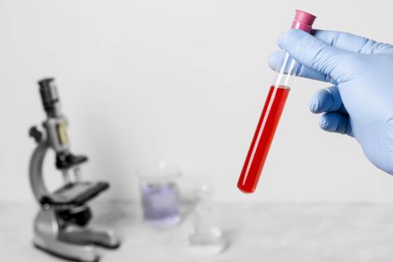 Análisis de sangre en CDMX