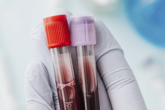 Centro de Hematología en CDMX
