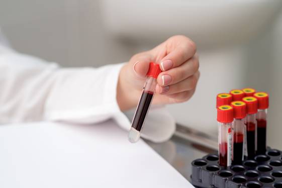 Doctor Hematólogo en CDMX