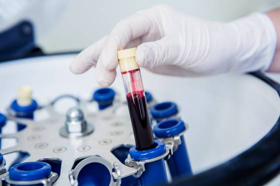Servicio de Hematología en CDMX